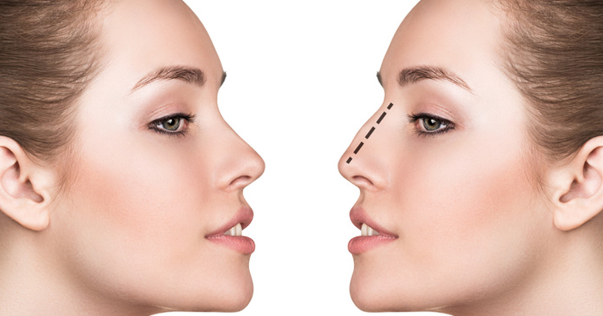 Comment combiner critères subjectifs et objectifs dans l’approche de la volumétrie du visage